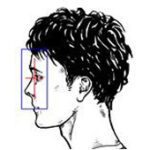 03 ixray Nasenbein seitl