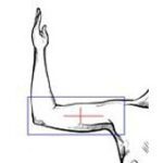 29-ixray_oberarm_elevation