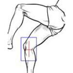 54-ixray_knie_seitlich