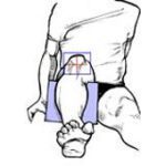 57-ixray_patella_axial_ii