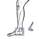 65-ixray_calcaneus_seitlich